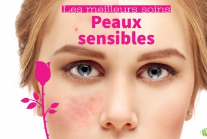 Les meilleurs soins anti-rougeurs